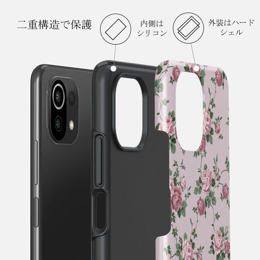 Alice - Xiaomi Mi 11 Lite 4G / 5G ケース 2