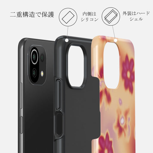 Divine - Xiaomi Mi 11 Lite 4G / 5G ケース 2