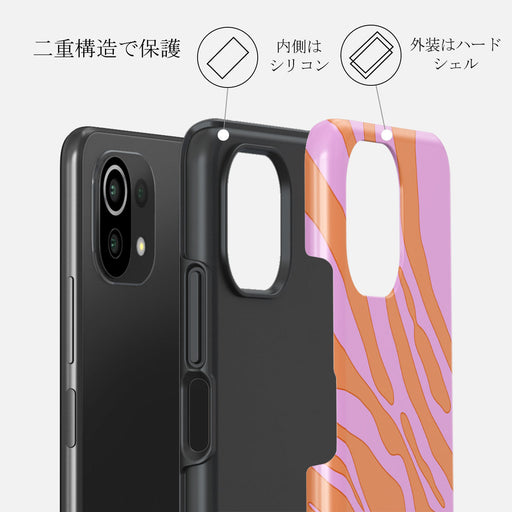 Spicy - Xiaomi 11 Lite 5G NE ケース 2