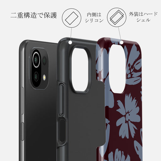 Darlin - Xiaomi 11 Lite 5G NE ケース 2