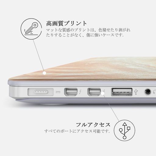 Serene Sunset - Macbook ハードケース 20