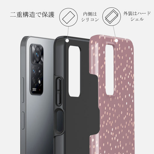 Hot Cocoa - Spotted Xiaomi Redmi Note 11 Pro+ Case 2