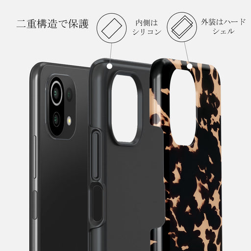 Betty - Xiaomi 11 Lite 5G NE Case 2