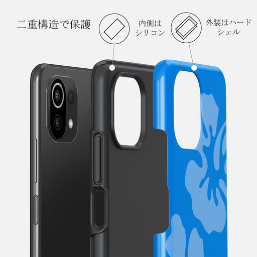 Lagoon - Xiaomi 11 Lite 5G NE ケース 2