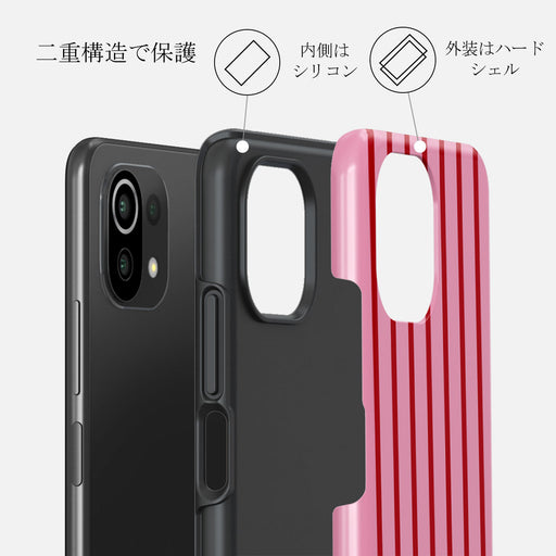 Favorite Bikini - Xiaomi Mi 11 Lite 4G / 5G ケース 2