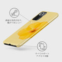 Hibiscus - Xiaomi Redmi Note 10 Pro ケース 3