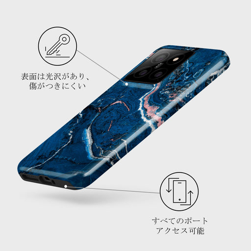 Blue Lagoon - Xiaomi 14 ケース 3