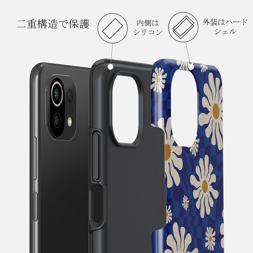 Art Class - Xiaomi Mi 11 Lite 4G / 5G ケース 2