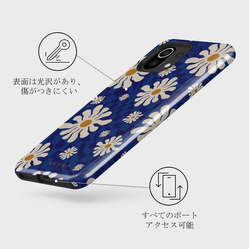 Art Class - Xiaomi Mi 11 Lite 4G / 5G ケース 3