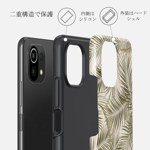 Happy Place - Palm Xiaomi Mi 11 Lite 4G / 5G ケース 2