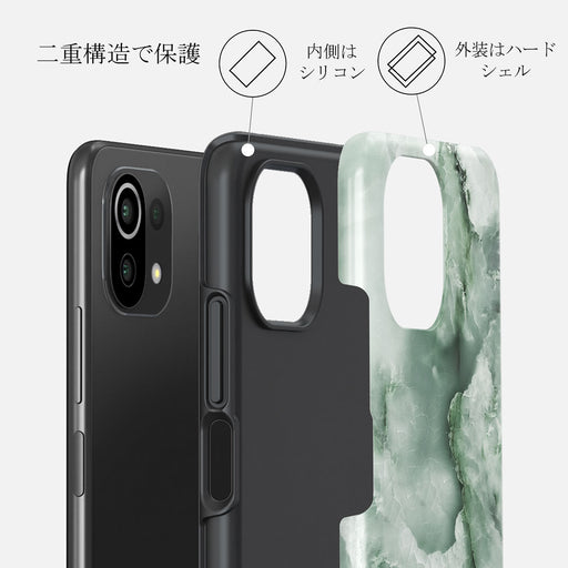 Pistachio Cheesecake - Green Xiaomi 11 Lite 5G NE ケース 2
