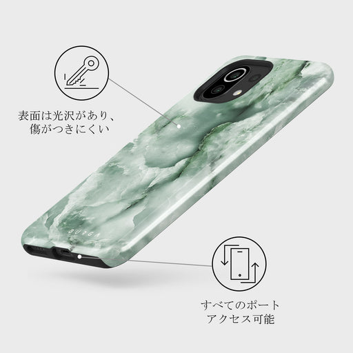 Pistachio Cheesecake - Green Xiaomi 11 Lite 5G NE ケース 3